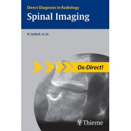 Spinal Imaging: Direct Diagnosis in Radiology