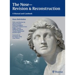 The Nose - Revision and Reconstruction: A Manual and Casebook