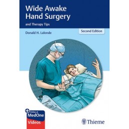 Wide Awake Hand Surgery and Therapy Tips