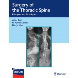 Surgery of the Thoracic...