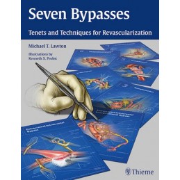 Seven Bypasses: Tenets and...