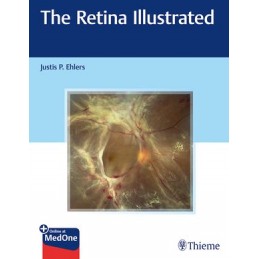 The Retina Illustrated