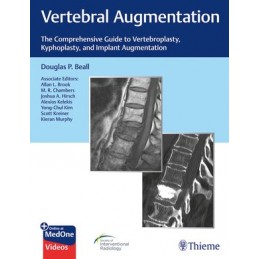 Vertebral Augmentation: The Comprehensive Guide to Vertebroplasty, Kyphoplasty, and Implant Augmentation