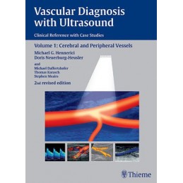 Vascular Diagnosis with...