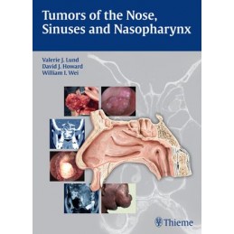 Tumors of the Nose, Sinuses...