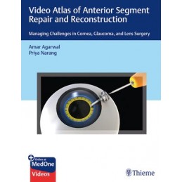 Video Atlas of Anterior Segment Repair and Reconstruction: Managing Challenges in Cornea, Glaucoma, and Lens Surgery