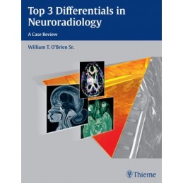 Top 3 Differentials in Neuroradiology: A Case Review