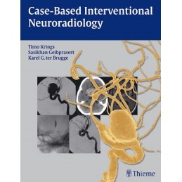 Case-Based Interventional Neuroradiology