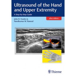 Ultrasound of the Hand and Upper Extremity: A Step-by-Step Guide