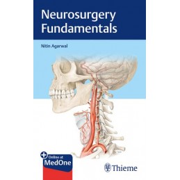 Neurosurgery Fundamentals