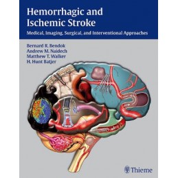 Hemorrhagic and Ischemic Stroke: Medical, Imaging, Surgical and Interventional  Approaches