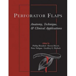 Perforator Flaps: Anatomy,...