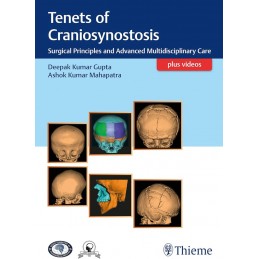 Tenets of Craniosynostosis:...