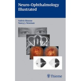 Neuro-Ophthalmology...