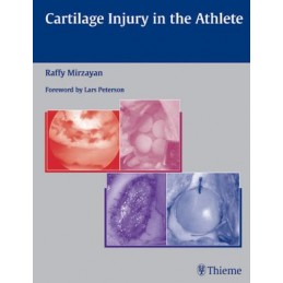 Cartilage Injury in the Athlete