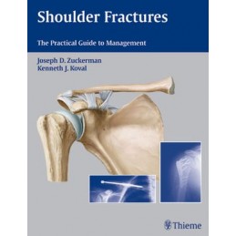 Shoulder Fractures: The...