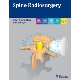 Spine Radiosurgery