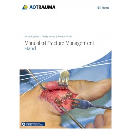 Manual of Fracture...