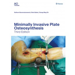 Minimally Invasive Plate...
