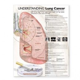 Understanding Lung Cancer...