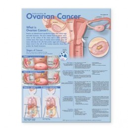 Understanding Ovarian...