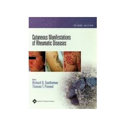 Cutaneous Manifestations of Rheumatic Diseases