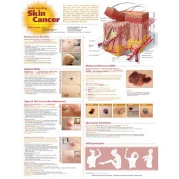 Understanding Skin Cancer...