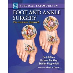 Surgical Exposures in Foot...