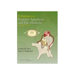 Complications in Regional Anesthesia and Pain Medicine