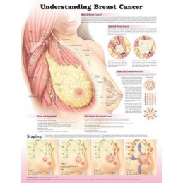 Understanding Breast Cancer 3E Laminated