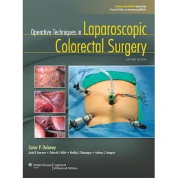 Operative Techniques in Laparoscopic Colorectal Surgery