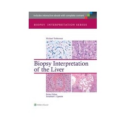 Biopsy Interpretation of...
