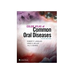 Color Atlas of Common Oral...