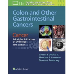 Colon and Other Gastrointestinal Cancers: Cancer:  Principles & Practice of Oncology, 10th edition