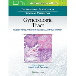 Differential Diagnoses in Surgical Pathology: Gynecologic Tract