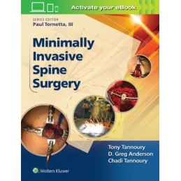 Minimally Invasive Spine...