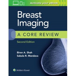 Breast Imaging: A Core Review