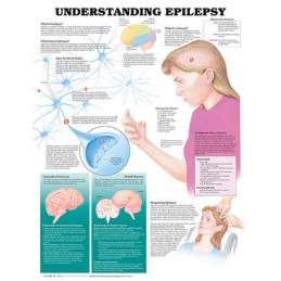 Understanding Epilepsy...