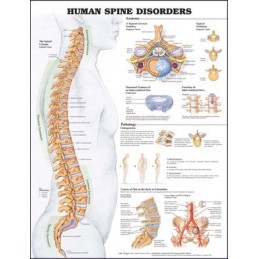 Human Spine Disorders...