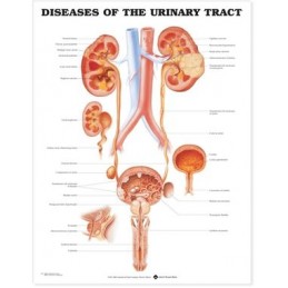 Diseases of the Urinary...