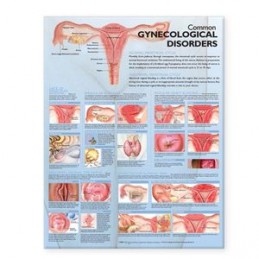 Common Gynecological...