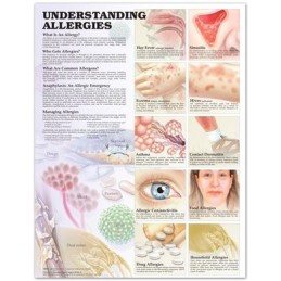 Understanding Allergies...