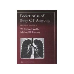 Pocket Atlas of Body CT...