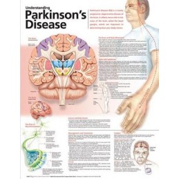 Understanding Parkinson's Disease Anatomical Chart