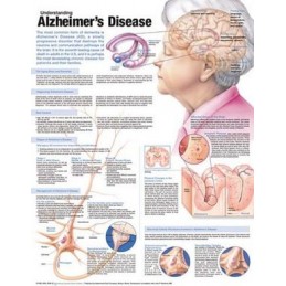 Understanding Alzheimer's...
