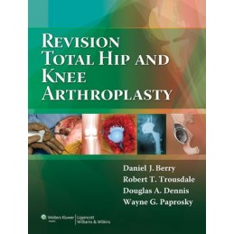 Revision Total Hip and Knee...