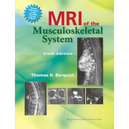 MRI of the Musculoskeletal...