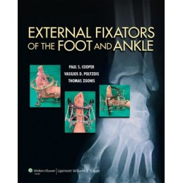 External Fixators of the...