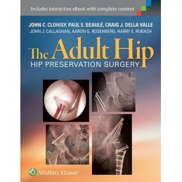The Adult Hip: Hip Preservation Surgery