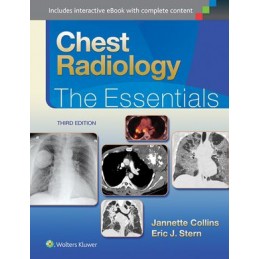 Chest Radiology: The...